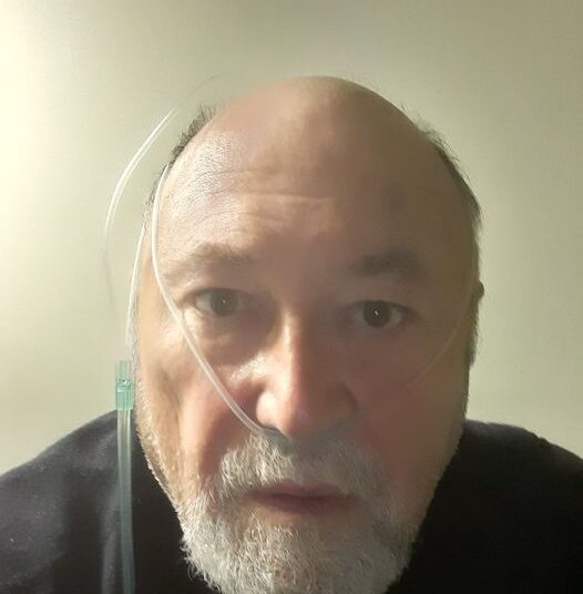 Едва спасиха Големия Ал от COVID